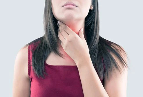 Goiter